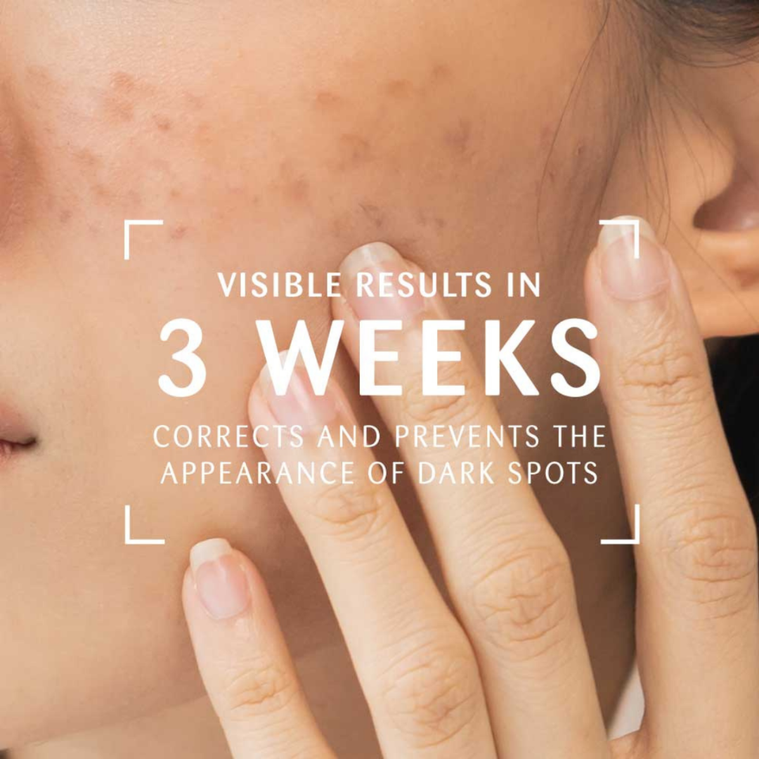 VIDADERM Anti-Dark Spot Cream