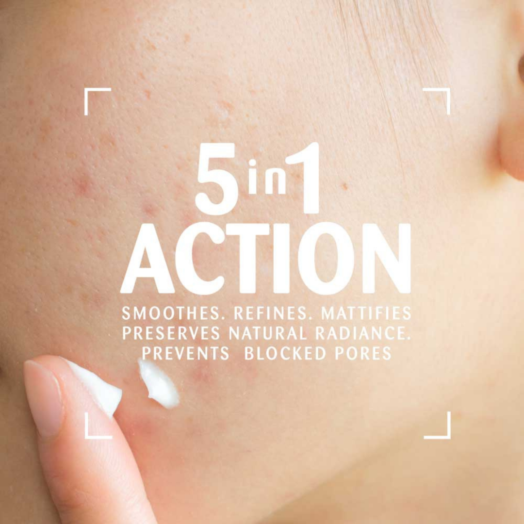 Vidaderm Anti-Sebo Treatment Cream | Reduce Oil by 34% in 14 Days