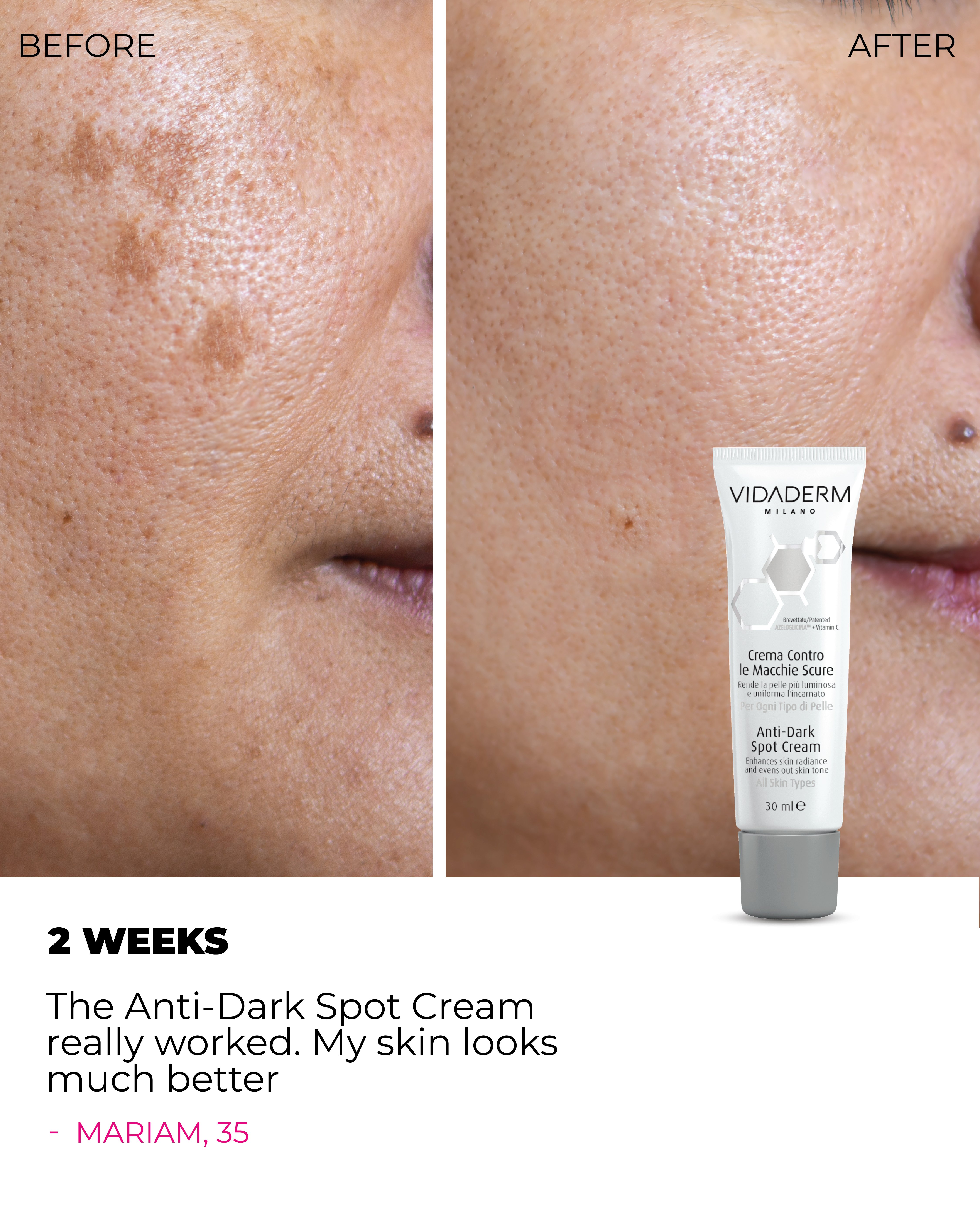 VIDADERM Anti-Dark Spot Cream