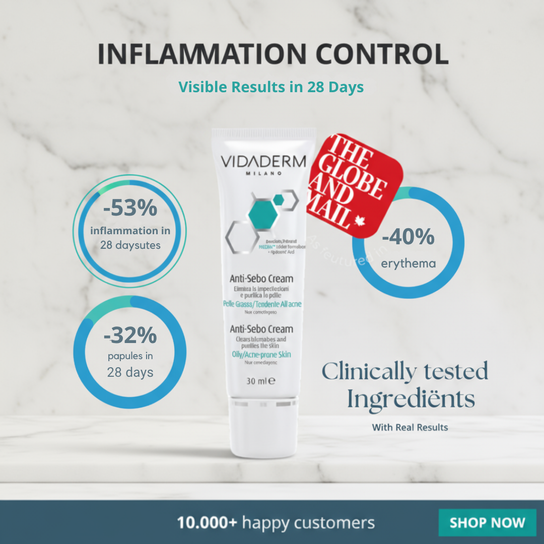 Vidaderm Anti-Sebo Treatment Cream | Reduce Oil by 34% in 14 Days