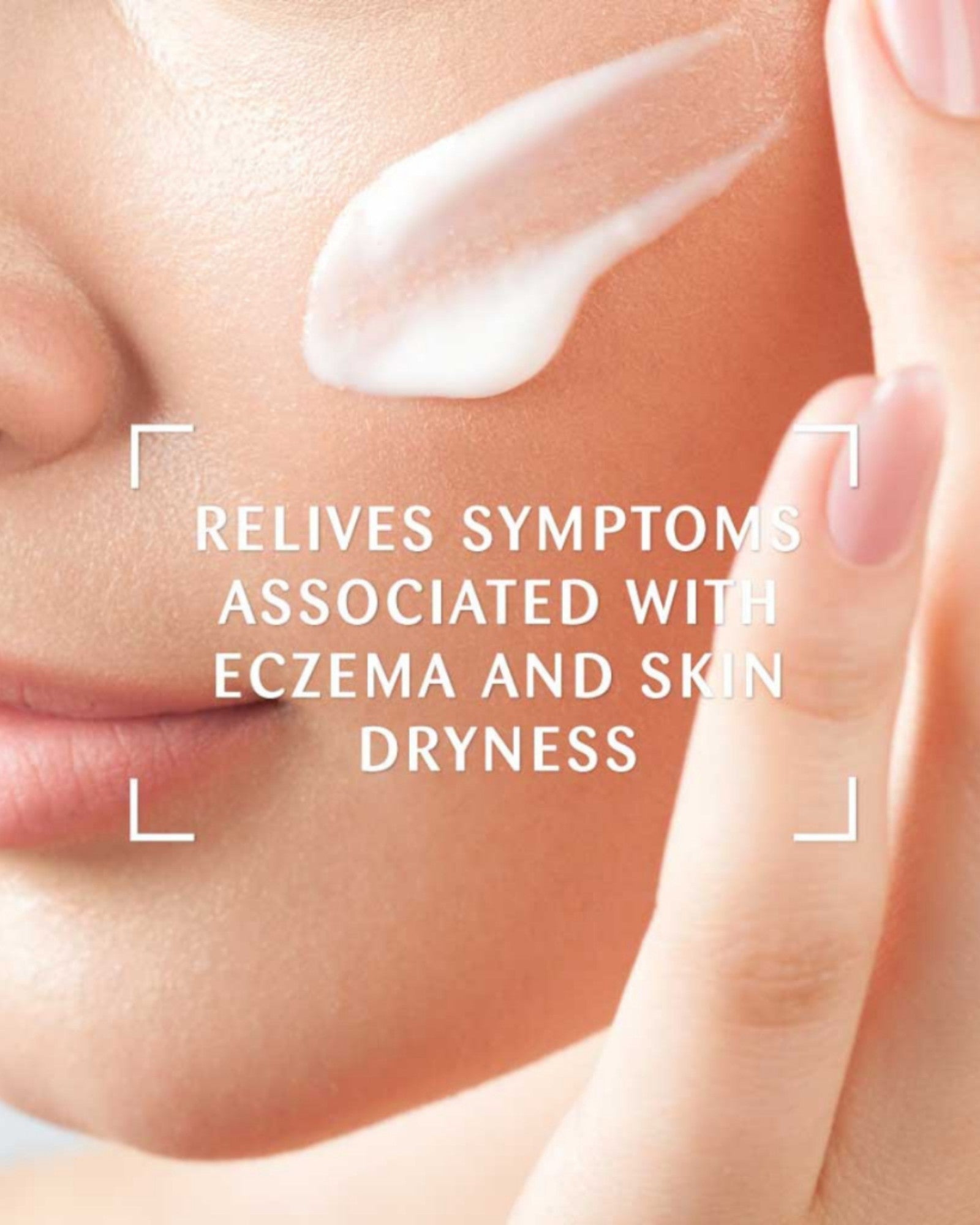 VIDADERM Intense Soothing Cream